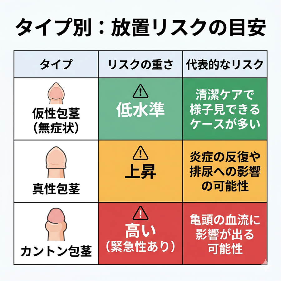 仮性、真性、カントン包茎の放置リスクの目安の比較表。仮性は低水準、真性は上昇、カントンは高いリスクがある